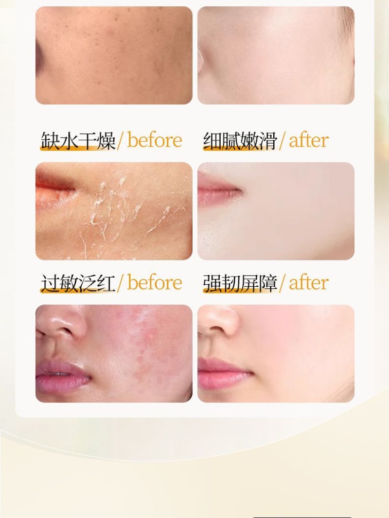 무광택 피부 개선 페이스 토너 에센스, 비타민 C 항산 - Essence Serum Toner 리뷰 및 가격